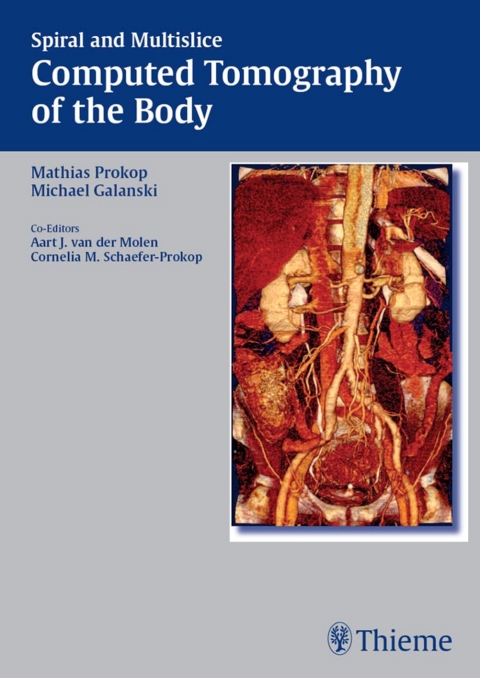 Spiral and Multislice Computed Tomography of the Body, 1st  Edition - FULL INSTANT DOWNLOAD | PDF DOCX EPUB