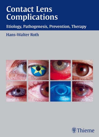 Cover image: Contact Lens Complications 1st edition 9783131277916