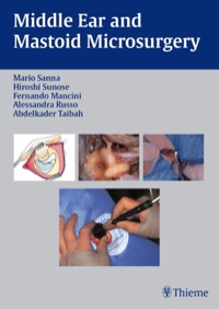 Omslagafbeelding: Middle Ear and Mastoid Microsurgery 1st edition 9783131607317