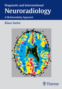 Cover image: Diagnostic and Interventional Neuroradiology 1st edition 9783131300812