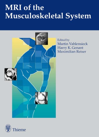 Imagen de portada: MRI of the Musculoskeletal System 1st edition 9783131607911