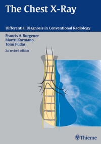 Cover image: The Chest X-Ray 2nd edition 9783131076120