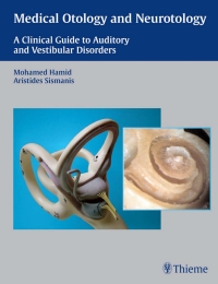 Imagen de portada: Medical Otology and Neurotology 1st edition 9781588903020