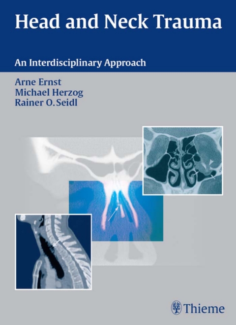 Head and Neck Trauma: An Interdisciplinary Approach, 1st  Edition - FULL INSTANT DOWNLOAD | PDF DOCX EPUB