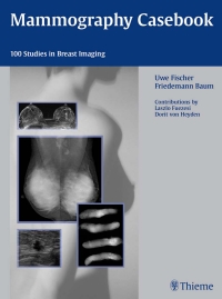 Cover image: Mammography Casebook 1st edition 9781588903501