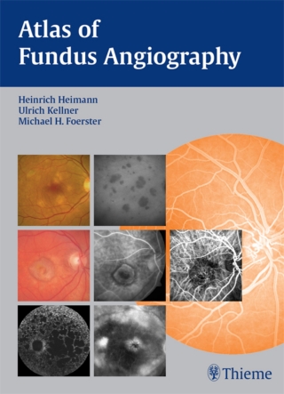 Cover image: Atlas of Fundus Angiography 1st edition 9781588904386