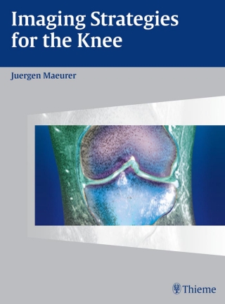 Cover image: Imaging Strategies for the Knee 1st edition 9783131405616