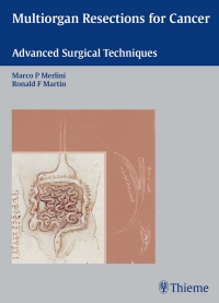 Cover image: Multiorgan Resections for Cancer 1st edition 9781588903549