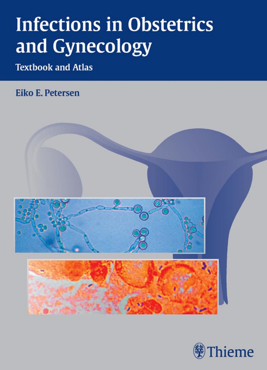 Infections in Obstetrics and Gynecology Textbook and Atlas 1st Edition
    Newer Edition Available