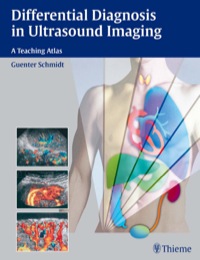 Cover image: Differential Diagnosis in Ultrasound Imaging 1st edition 9783131615817