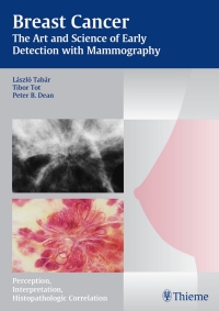 Cover image: Breast Cancer - The Art and Science of Early Detection with Mammography 1st edition 9783131353719