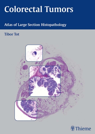 Cover image: Colorectal Tumors 1st edition 9783131405913