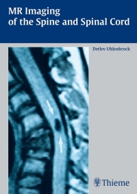 Cover image: MR Imaging of the Spine and Spinal Cord 1st edition 9781588902641