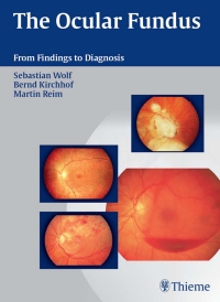 Imagen de portada: The Ocular Fundus 1st edition 9781588903389