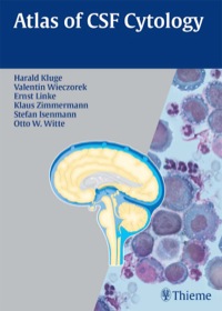 Imagen de portada: Atlas of CSF Cytology 1st edition 9781588905468