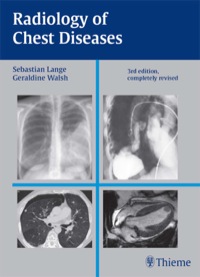 Cover image: Radiology of Chest Diseases 3rd edition 9781588904478