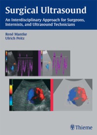 Cover image: Surgical Ultrasound 1st edition 9781588901903
