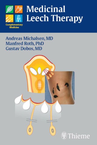 Cover image: Medicinal Leech Therapy 1st edition 9781588905635