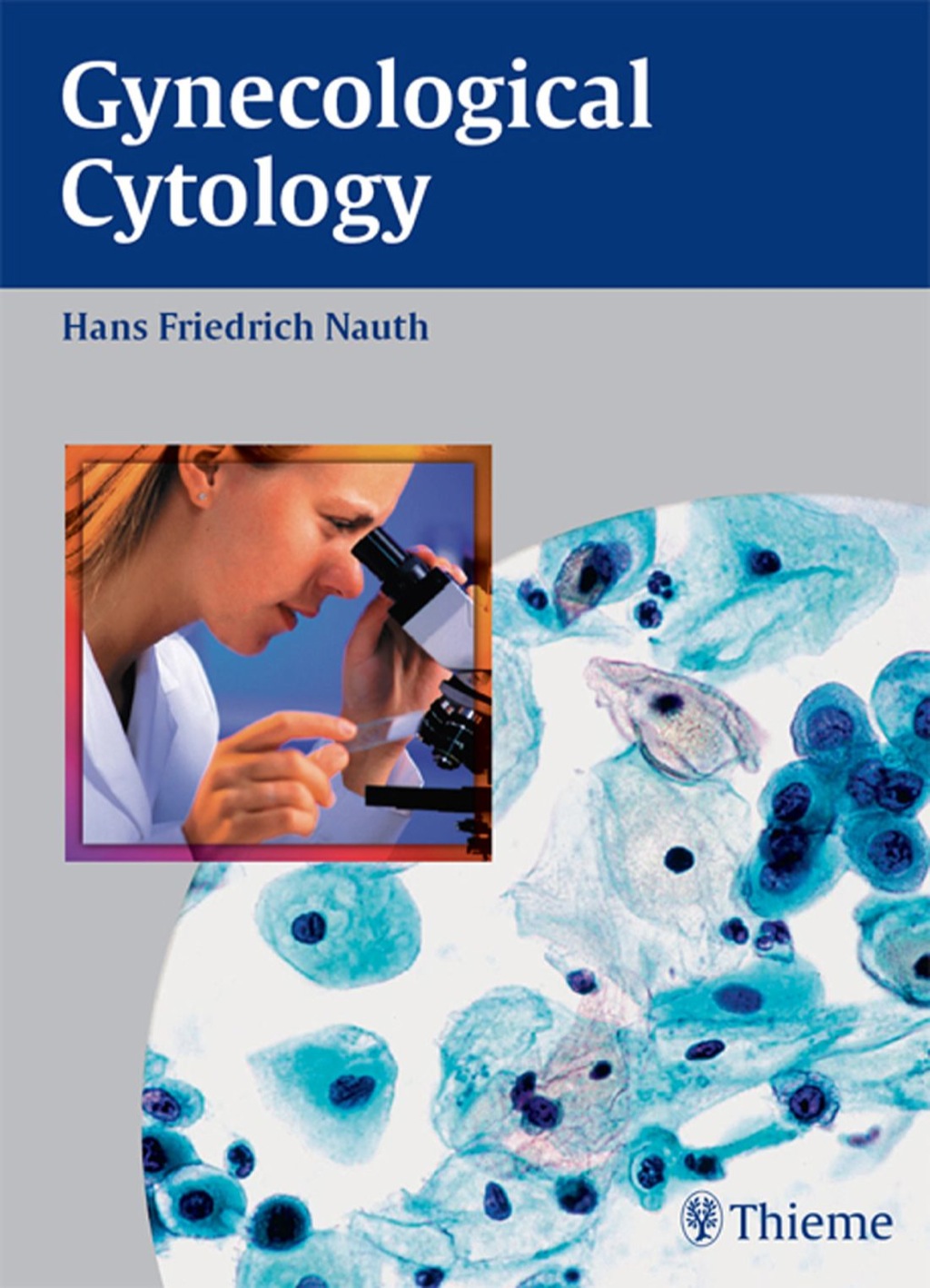 Gynecological Cytology 1st Edition
    Newer Edition Available