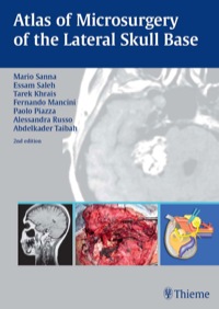 Cover image: Atlas of Microsurgery of the Lateral Skull Base 2nd edition 9781588900111