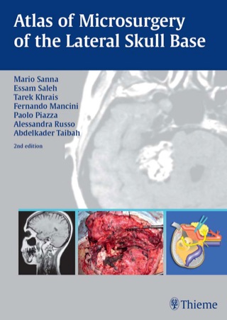 Cover image: Atlas of Microsurgery of the Lateral Skull Base 2nd edition 9783131010926