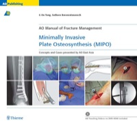 Cover image: Minimally Invasive Plate Osteosynthesis (MIPO): Concepts and cases presented by the AO East Asia 1st edition 9781588905444