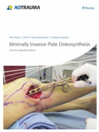 Cover image: Minimally Invasive Plate Osteosynthesis (MIPO) 2nd edition 9783131433923