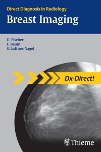 表紙画像: Breast Imaging 1st edition 9781604060416