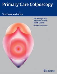 Titelbild: Primary Care Colposcopy 1st edition 9783131627117