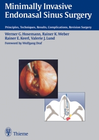 Cover image: Minimally Invasive Endonasal Sinus Surgery 1st edition 9783131246110