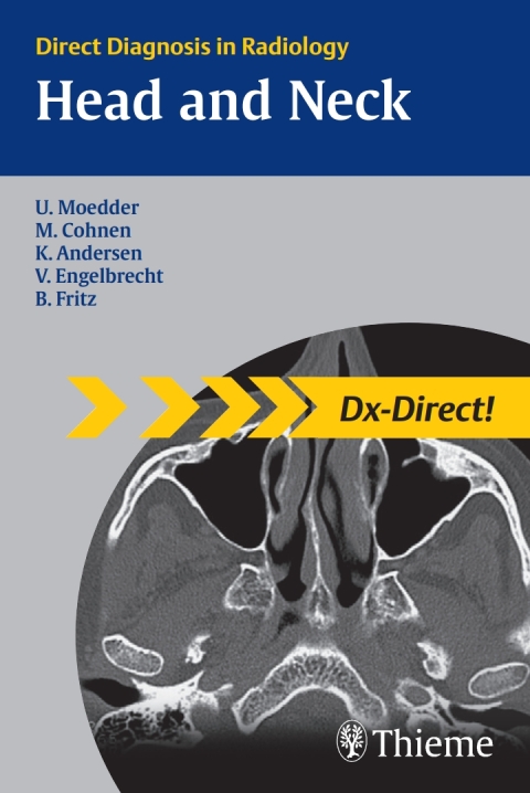 Head and Neck Imaging: Direct Diagnosis in Radiology, 1st  Edition - FULL INSTANT DOWNLOAD | PDF DOCX EPUB