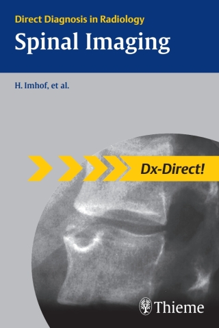Cover image: Spinal Imaging 1st edition 9781588905604