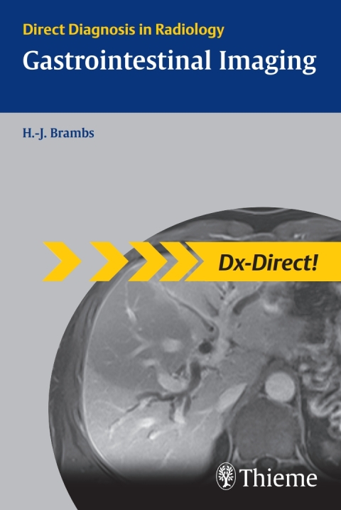 Gastrointestinal Imaging: Direct Diagnosis in Radiology, 1st  Edition - FULL INSTANT DOWNLOAD | PDF DOCX EPUB