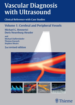 Cover image: Vascular Diagnosis with Ultrasound 2nd edition 9783131038326