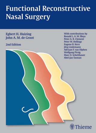Imagen de portada: Functional Reconstructive Nasal Surgery 2nd edition 9783131294128