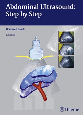 Cover image: Abdominal Ultrasound: Step by Step 2nd edition 9783131645425