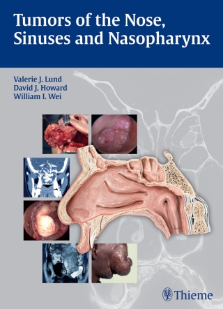 صورة الغلاف: Tumors of the Nose, Sinuses and Nasopharynx 1st edition 9783131471918