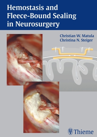 Cover image: Hemostasis and Fleece-Bound Sealing in Neurosurgery 1st edition 9783131320414
