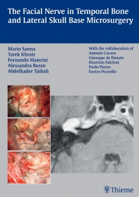 表紙画像: The Facial Nerve in Temporal Bone and Lateral Skull Base Microsurgery 1st edition 9781588903822