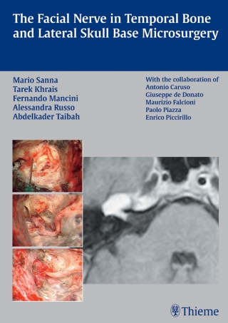 Imagen de portada: The Facial Nerve in Temporal Bone and Lateral Skull Base Microsurgery 1st edition 9783131412812