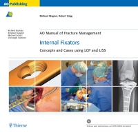 Titelbild: AO Manual of Fracture Management: Internal Fixators 1st edition 9781588904867