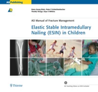 Cover image: Elastic Stable Intramedullary Nailing (ESIN) in Children 1st edition 9783131433312