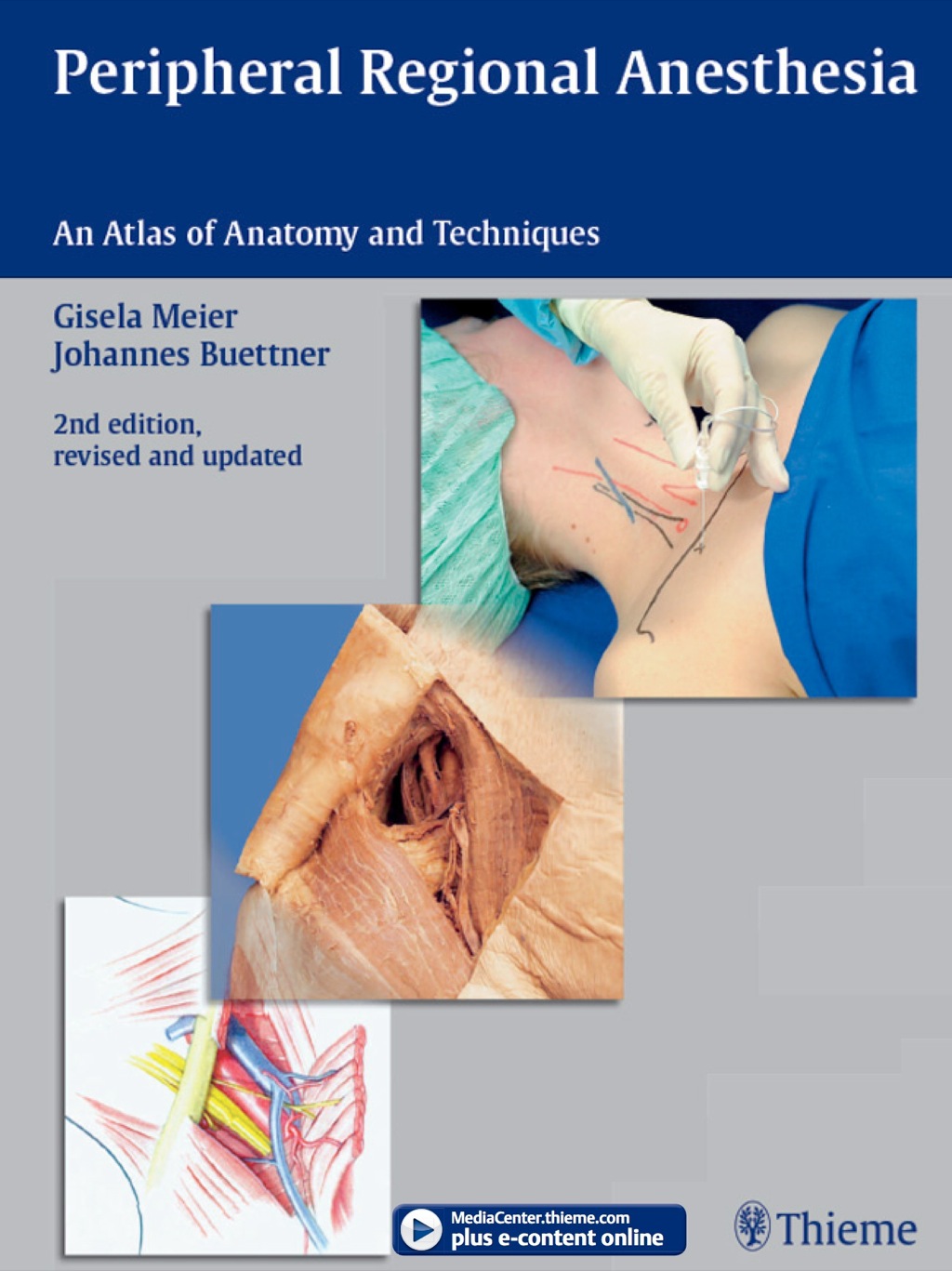 Peripheral Regional Anesthesia An Atlas of Anatomy and Techniques 2nd Edition