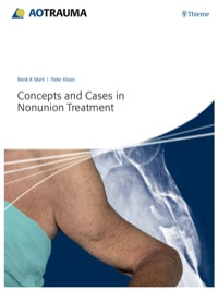 Omslagafbeelding: Concepts and Cases in Nonunion Treatment 1st edition 9783131658517