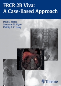 Cover image: FRCR 2B Viva: A Case-Based Approach 1st edition 9783131662910