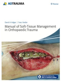 Cover image: Manual of Soft-Tissue Management in Orthopaedic Trauma 1st edition 9783131663719