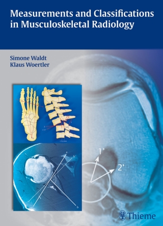 Omslagafbeelding: Measurements and Classifications in Musculoskeletal Radiology 1st edition 9783131692719