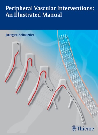 Cover image: Peripheral Vascular Interventions: An Illustrated Manual 1st edition 9783131697516