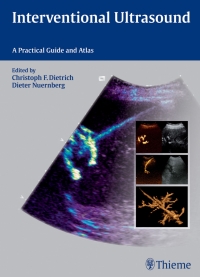 Cover image: Interventional Ultrasound 1st edition 9783131708212