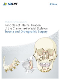 Cover image: Principles of Internal Fixation of the Craniomaxillofacial Skeleton 1st edition 9783132453180